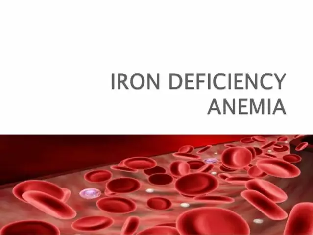 Iron-Deficiency Anemia: Causes, Symptoms, and Prevention